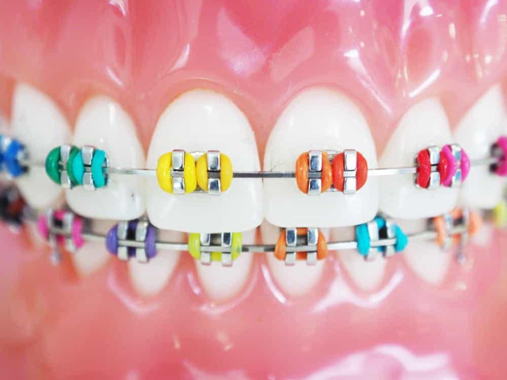 Orthodontie