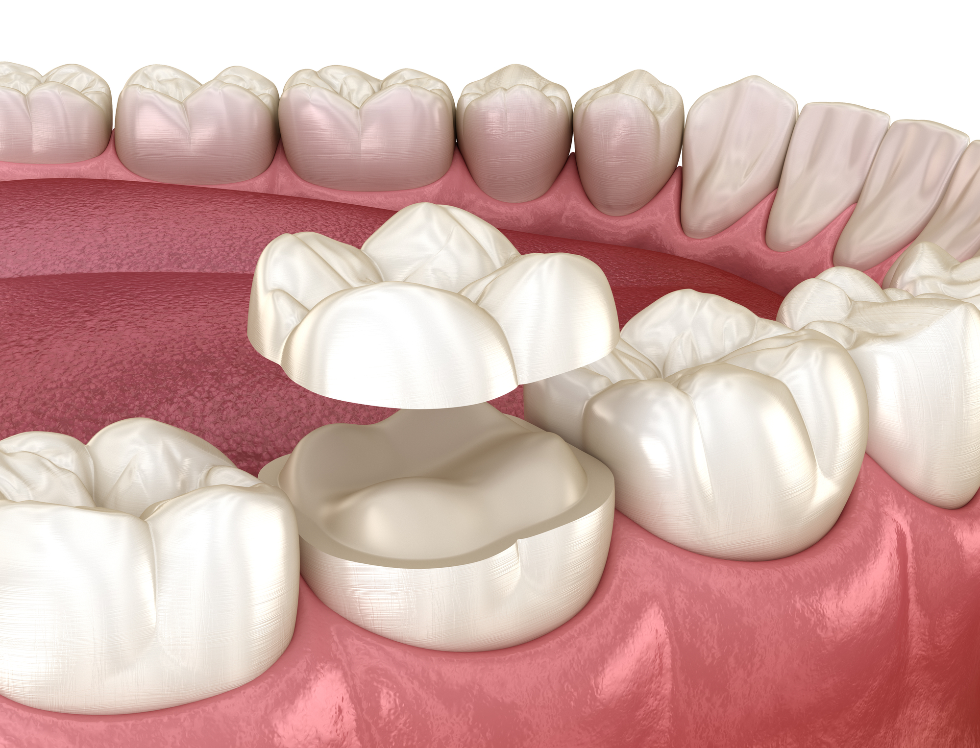 Dentisterie générale